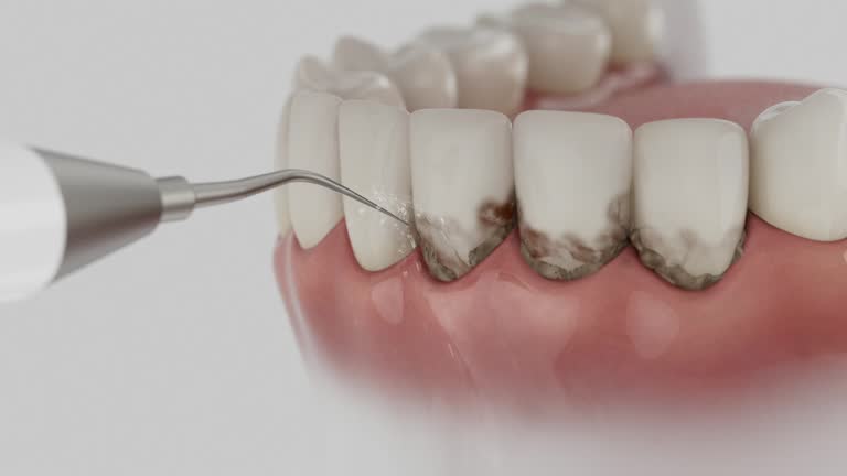 Trusted Tooth Extraction service in Cadiz, OH - Dentist Open Now